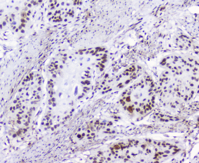 HMGN2 Antibody in Immunohistochemistry (Paraffin) (IHC (P))