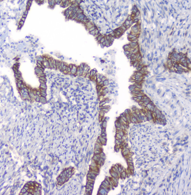 PKC beta-1 Antibody in Immunohistochemistry (Paraffin) (IHC (P))