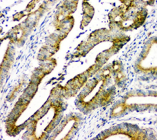 DOK7 Antibody in Immunohistochemistry (Paraffin) (IHC (P))