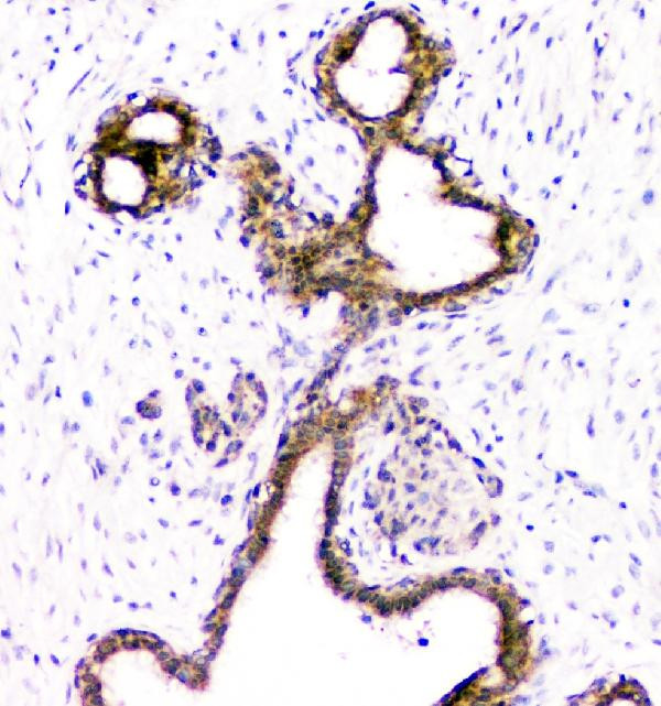 DOK7 Antibody in Immunohistochemistry (Paraffin) (IHC (P))