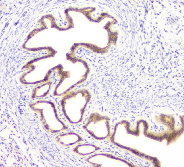 DOK7 Antibody in Immunohistochemistry (Paraffin) (IHC (P))