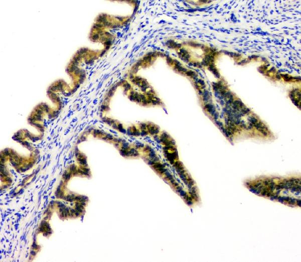 DOK7 Antibody in Immunohistochemistry (Paraffin) (IHC (P))