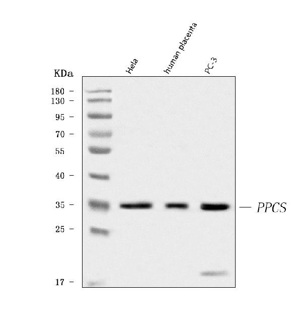 PPCS Antibody in Western Blot (WB)