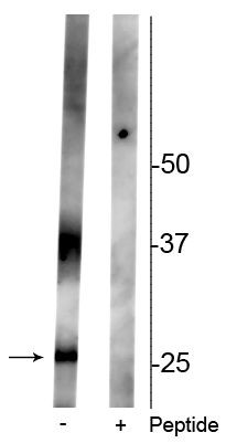 Phospho-Aquaporin 2 (Ser261) Antibody in Western Blot (WB)