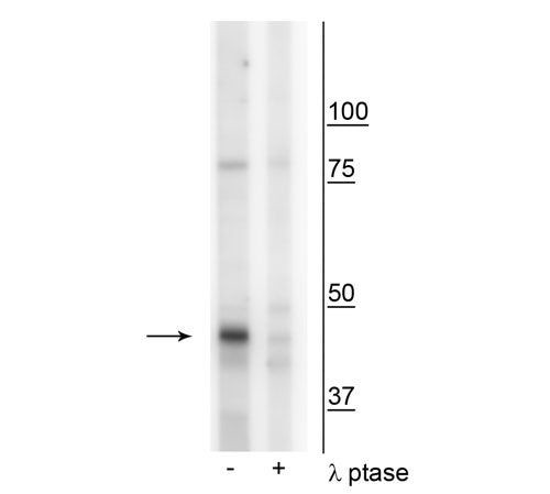 Phospho-Creatine Kinase MT (Tyr153) Antibody in Western Blot (WB)