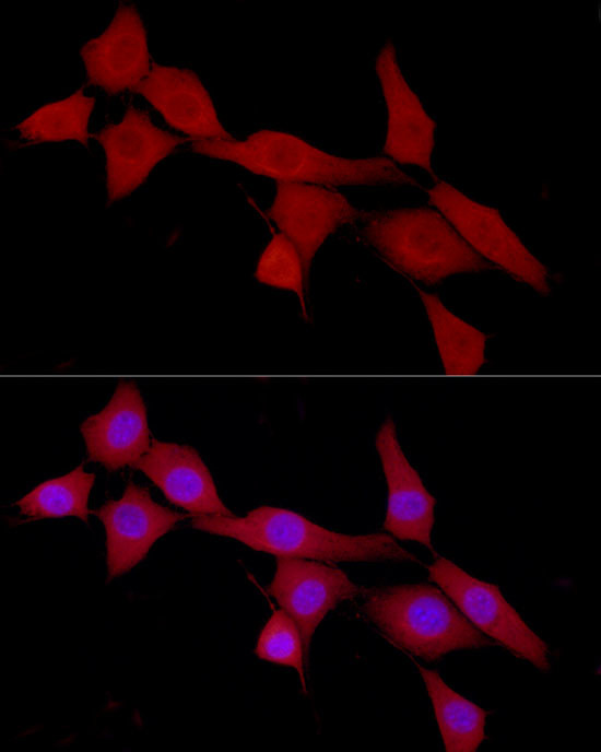 CAB39 Antibody in Immunocytochemistry (ICC/IF)