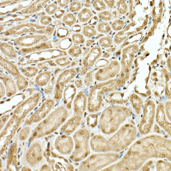 KIAA1429 Antibody in Immunohistochemistry (Paraffin) (IHC (P))