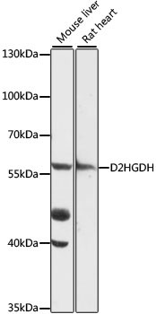 D2HGDH Antibody in Western Blot (WB)