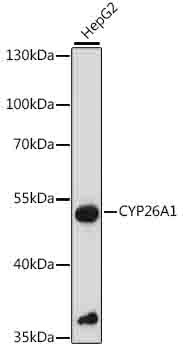 CYP26A1 Antibody in Western Blot (WB)