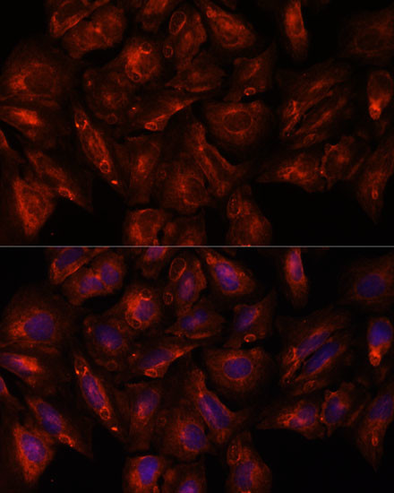 ITSN2 Antibody in Immunocytochemistry (ICC/IF)