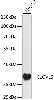 ELOVL5 Antibody in Western Blot (WB)