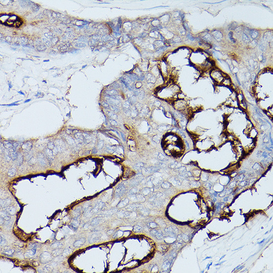 CEACAM1 Antibody in Immunohistochemistry (Paraffin) (IHC (P))