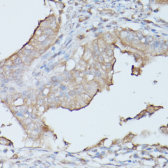 CEACAM1 Antibody in Immunohistochemistry (Paraffin) (IHC (P))