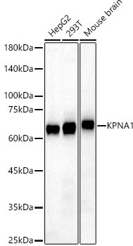 KPNA1 Antibody in Western Blot (WB)