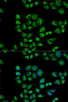 CD1d Antibody in Immunocytochemistry (ICC/IF)