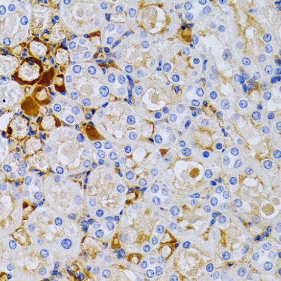 TFF1 Antibody in Immunohistochemistry (Paraffin) (IHC (P))