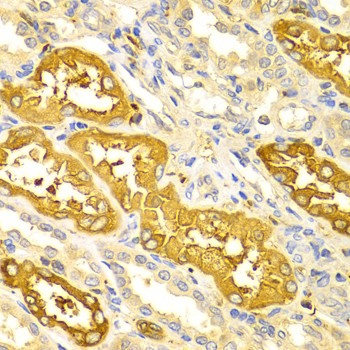 BIN1 Antibody in Immunohistochemistry (Paraffin) (IHC (P))