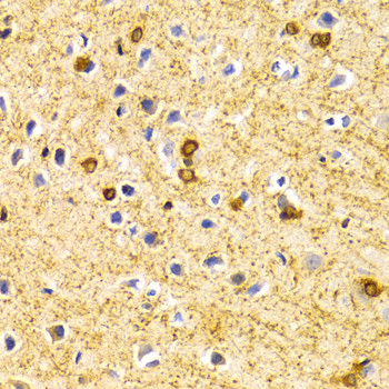 BIN1 Antibody in Immunohistochemistry (Paraffin) (IHC (P))