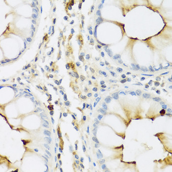 RNASE3 Antibody in Immunohistochemistry (Paraffin) (IHC (P))