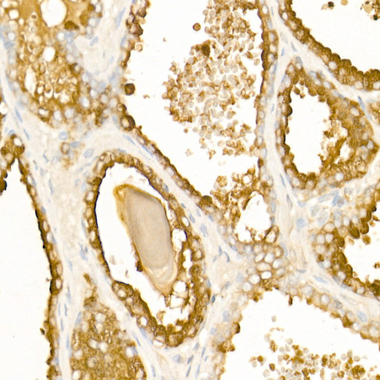 Prostate Specific Acid Phosphatase Antibody in Immunohistochemistry (Paraffin) (IHC (P))