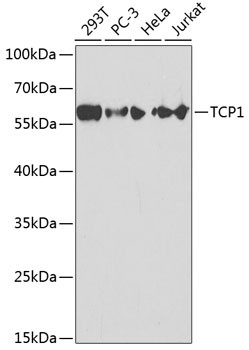 TCP1 Antibody in Western Blot (WB)