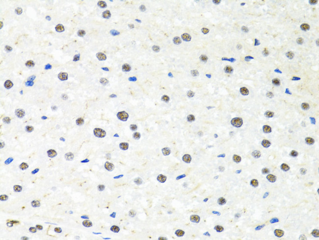 PPP4C Antibody in Immunohistochemistry (Paraffin) (IHC (P))