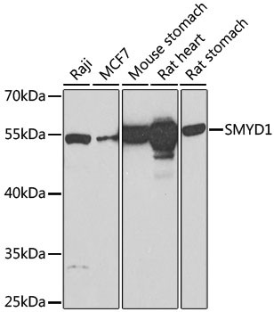 SMYD1 Antibody in Western Blot (WB)