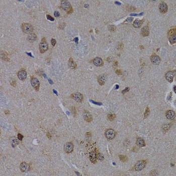 POLR2L Antibody in Immunohistochemistry (Paraffin) (IHC (P))