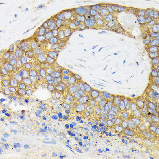 RPS3 Antibody in Immunohistochemistry (Paraffin) (IHC (P))