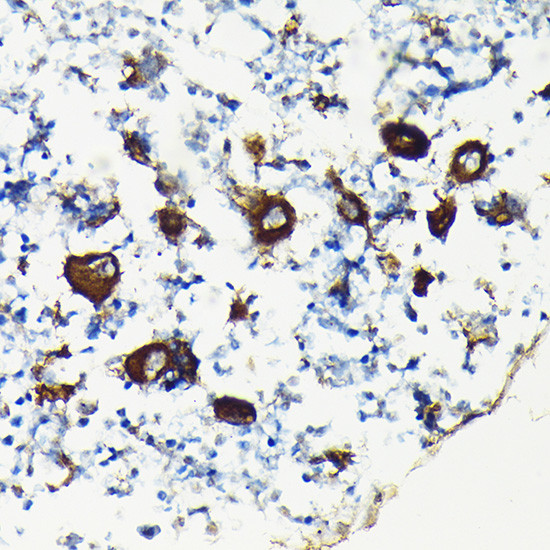 CD61 Antibody in Immunohistochemistry (Paraffin) (IHC (P))