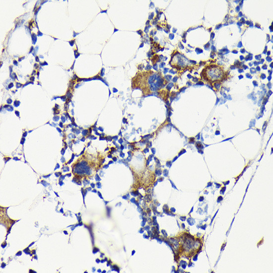 CD61 Antibody in Immunohistochemistry (Paraffin) (IHC (P))