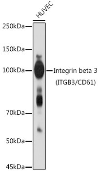 CD61 Antibody in Western Blot (WB)