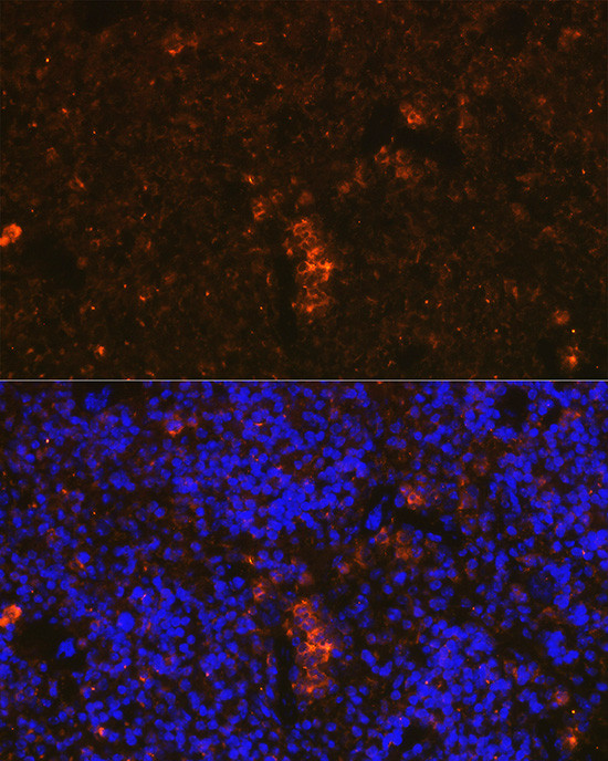 Granzyme B Antibody in Immunocytochemistry (ICC/IF)