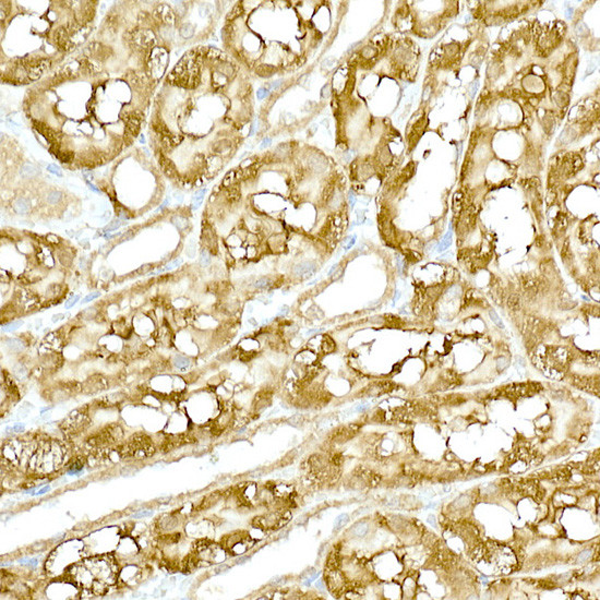 TBK1 Antibody in Immunohistochemistry (Paraffin) (IHC (P))