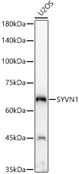 HRD1 Antibody in Western Blot (WB)