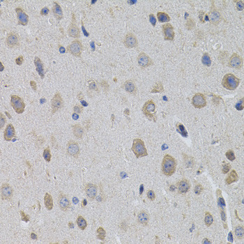 SUMO-3 Antibody in Immunohistochemistry (Paraffin) (IHC (P))