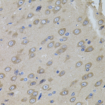 SUMO-3 Antibody in Immunohistochemistry (Paraffin) (IHC (P))