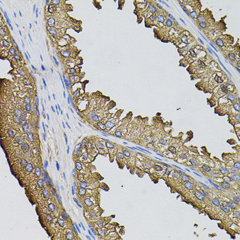 SUMO-3 Antibody in Immunohistochemistry (Paraffin) (IHC (P))