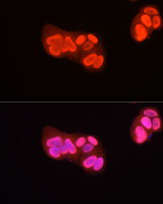 H3R2me2a Antibody in Immunocytochemistry (ICC/IF)