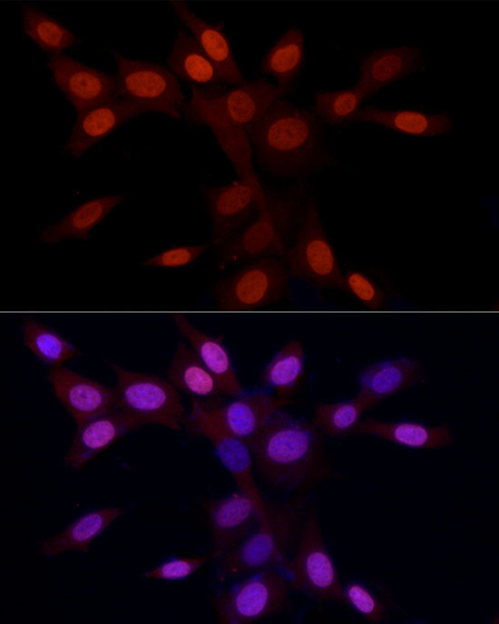 H3R2me2a Antibody in Immunocytochemistry (ICC/IF)