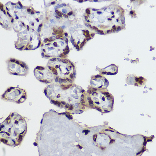 H4R3me2s Antibody in Immunohistochemistry (Paraffin) (IHC (P))