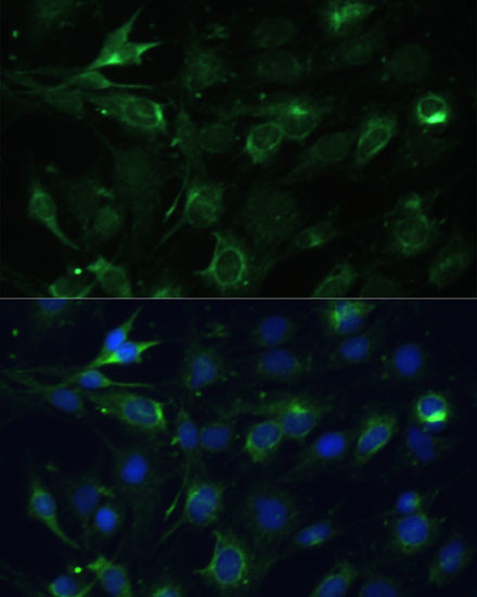 COX6A1 Antibody in Immunocytochemistry (ICC/IF)