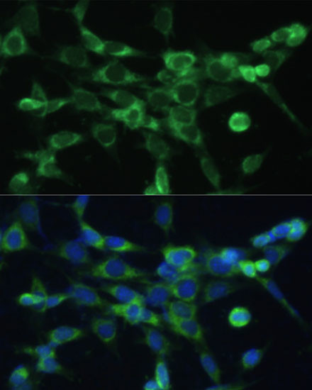 COX6A1 Antibody in Immunocytochemistry (ICC/IF)