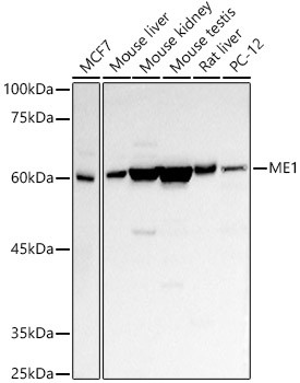 ME1 Antibody in Western Blot (WB)