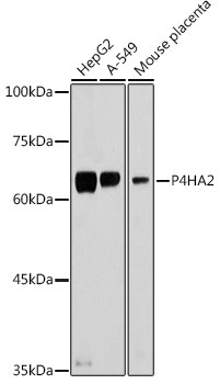 P4HA2 Antibody in Western Blot (WB)