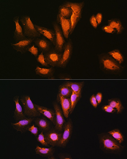 KAP3 Antibody in Immunocytochemistry (ICC/IF)