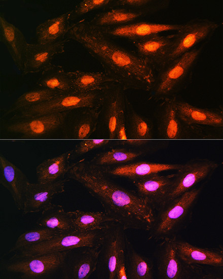 KAP3 Antibody in Immunocytochemistry (ICC/IF)