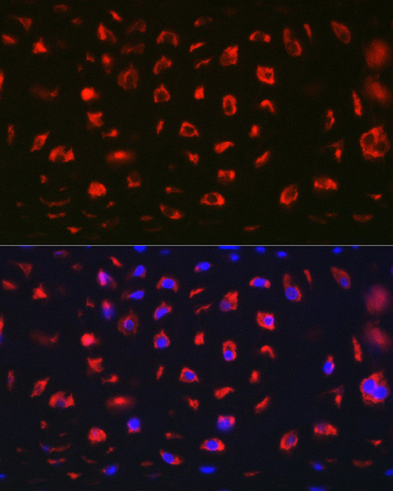 MGP Antibody in Immunohistochemistry (Paraffin) (IHC (P))