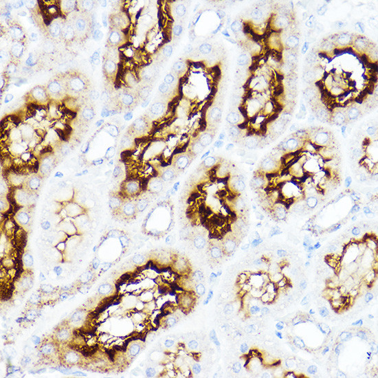 SLC3A1 Antibody in Immunohistochemistry (Paraffin) (IHC (P))