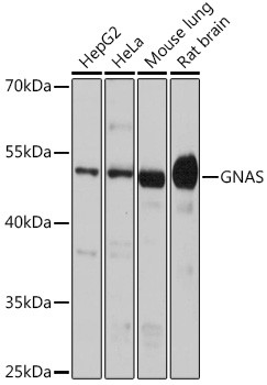 GNAS Antibody in Western Blot (WB)